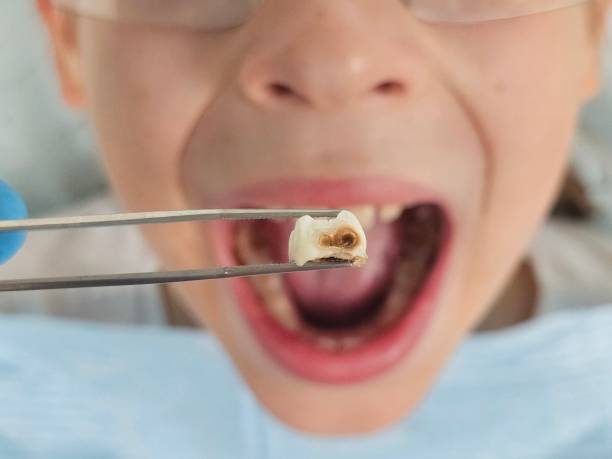 Best Walk-In Emergency Dentist in Trent Woods, NC